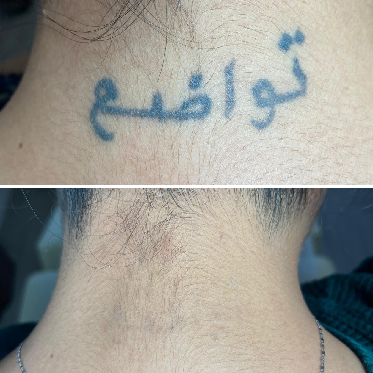 Tatto